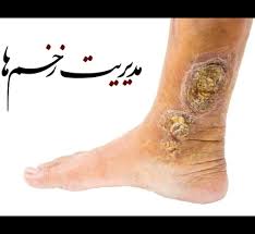 پاورپوینت فصل هفتم ترمیم زخم لارنس 2019 و شوارتز 2019 (ppt) 55 اسلاید