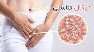 پاورپوینت بیماری های تناسلی مردان و زنان (ppt) 106 اسلاید